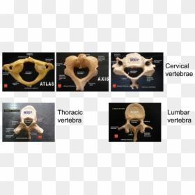 Types Of Vertebrae Anatomy, HD Png Download - bone pile png
