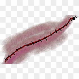 Stitches Png, Transparent Png - scar png