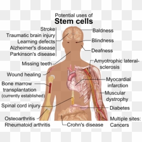 Stem Cell Treatments - Potential Uses Of Stem Cells, HD Png Download - injury png