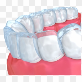 The Smile Center - Boxing Protective Gear, HD Png Download - invisalign logo png
