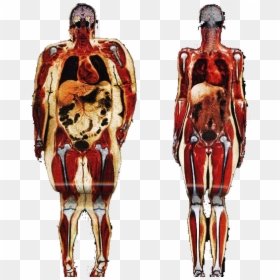 Obesity Human Body Adipose Tissue Anatomy Connective - Fat Person Vs Skinny Person, HD Png Download - obesity png