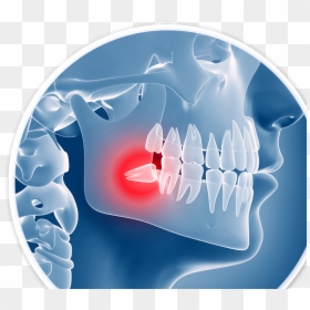 Dental Problems, HD Png Download - tooth png
