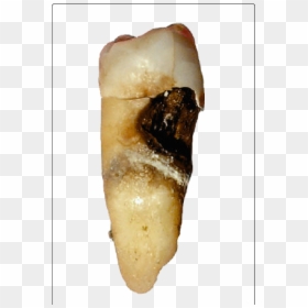Dantų Ėduonis, HD Png Download - tooth png