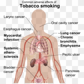 Common Adverse Effects Of Tobacco Smoking, HD Png Download - png effects