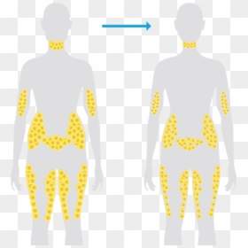 Fat Cell In Human Body, HD Png Download - fat person png