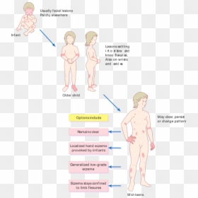 Pattern Of Atopic Eczema Varies With Age - Eczema Distribution By Age, HD Png Download - age png