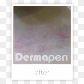 Art, HD Png Download - burn marks png