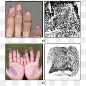 Example Images Of Altered Fingerprints - Fingerprint Alteration, HD Png Download - fingerprints png