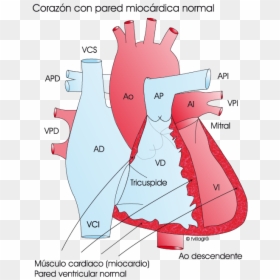 Tetralogia De Fallot Cirugia, HD Png Download - niños jugando png