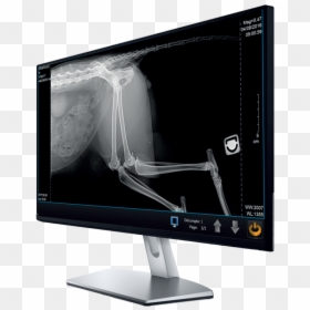 Computer Monitor, HD Png Download - xray png