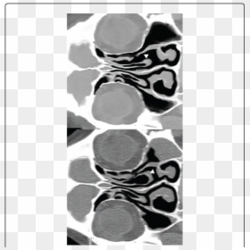 Monochrome, HD Png Download - concha png