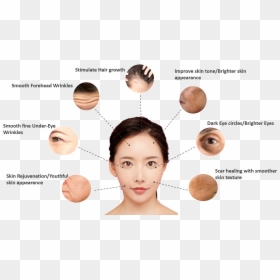 Prp 2 Main - Prp Treatment, HD Png Download - face scar png