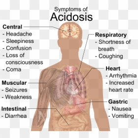 Symptoms Of Acidosis, HD Png Download - coughing png