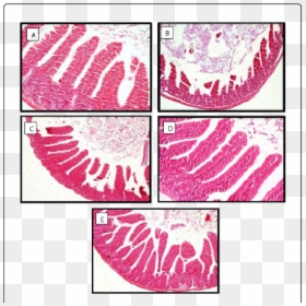 Clip Art, HD Png Download - small intestine png