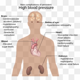 High Blood Pressure Diabetes, HD Png Download - blood cut png