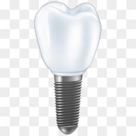 Dental Implant Png Clipart - Имплант Png, Transparent Png - street light clipart png
