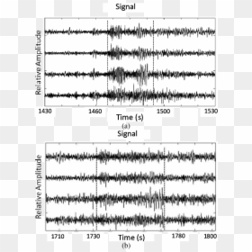 Epilepsy Seizure Example, HD Png Download - mit png