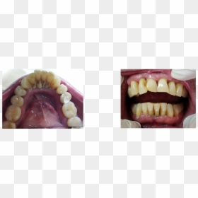 Dentistry, HD Png Download - humo de cigarro png