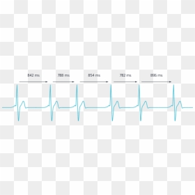 Heartbeat Rate Graph, HD Png Download - heartbeat png