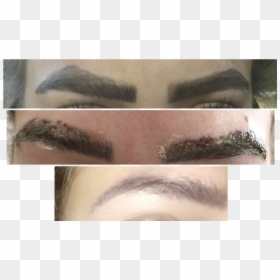 Eyebrow Tattoo Removal Process, HD Png Download - eyebrow png