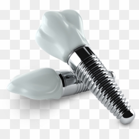 Dental Implants - Dental Implant Png, Transparent Png - gold tooth png