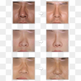 Bronze, HD Png Download - septum png