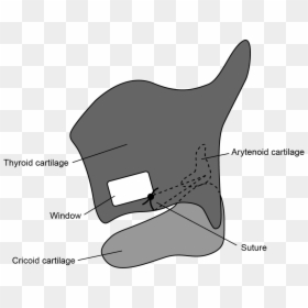 Arytenoid Adduction - Cartoon, HD Png Download - cartoon whale png