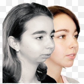 Fliehendes Kinn, HD Png Download - chin chin png