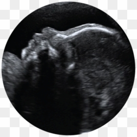 Prenatal Ultrasound Clipart, HD Png Download - ultrasound png