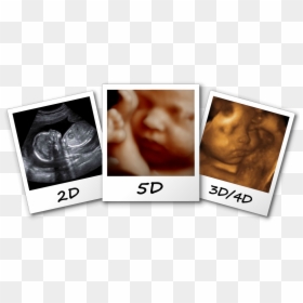 3d/4d/5d Ultrasound Fayetteville Nc Comparison Image - 3d 4d 5d Ultrasound, HD Png Download - ultrasound png