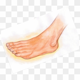 Angina-img29 - Sketch, HD Png Download - wockhardt png