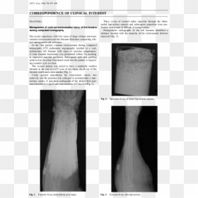 Medical Imaging, HD Png Download - forearm png