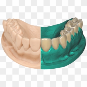 Dentures, HD Png Download - teeth smile png