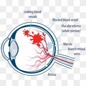 Retinal Eye Clip Art, HD Png Download - eye veins png
