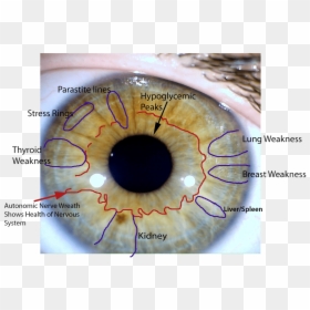 Kidney Stone Iridology, HD Png Download - eye veins png