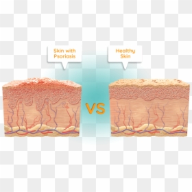 Psoriasis Dead Skin Cell, HD Png Download - sugar pile png