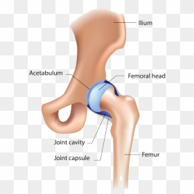 Posterior Wall Fracture Hip Dislocation, HD Png Download - femur png