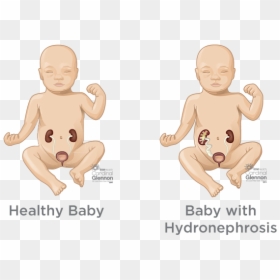 Blocked Bladder, HD Png Download - baby in womb png