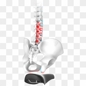 Spinal Disc Problems - X-ray, HD Png Download - back pain png