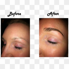 Prp Treatment For Eyebrows , Png Download, Transparent Png - eyebrows png