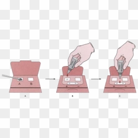 Digital Rectal Exam For Colorectal Cancer, HD Png Download - blood puddle png