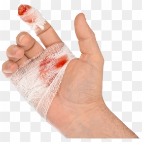 Steel Doctor Blade Injury Cut - Hand Cut Png Download, Transparent Png - blood hand png