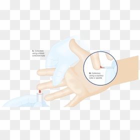 Collecting A Finger Capillary Blood Sample Via Blood - Blood Collection By Capillary Method, HD Png Download - blood hand png