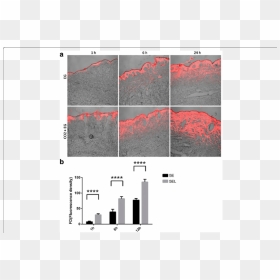 Hypertrophic Scar In Vitro Model, HD Png Download - scars png