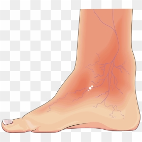 Diabetic Foot Png, Transparent Png - foot png