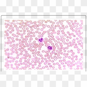 White Blood Cells, HD Png Download - blood smear png