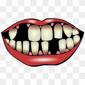 Lip Clipart Kiss Mark - Bad Teeth Clip Art, HD Png Download - kiss mark png