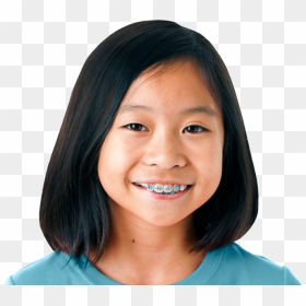 Girl With Braces Png, Transparent Png - girl.png