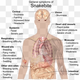 Infectious Mononucleosis, HD Png Download - bite mark png
