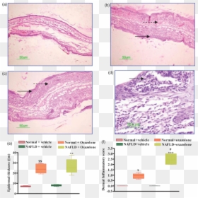 Mouse Ear Inflammation Histo, HD Png Download - mouse ears png